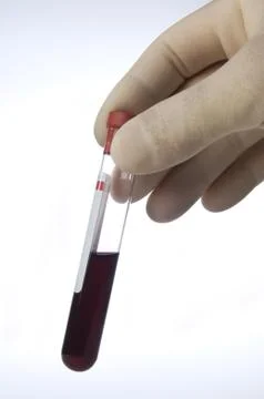 Tubes, and blood samples Stock Photos