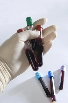 Tubes, and blood samples Stock Photos