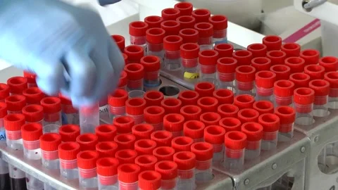 Tubes with bar code for analysis of blood samples in the hospital table Stock Footage 153005583