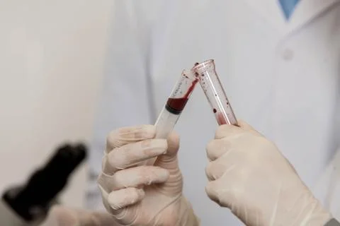Tubes with blood Stock Photos