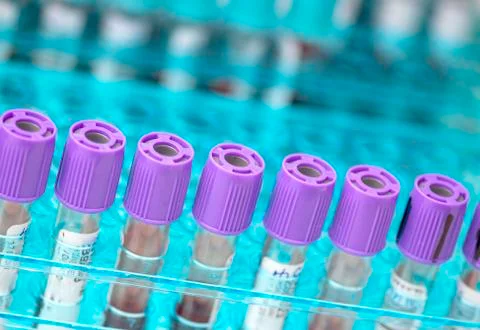 Tubes of blood sample for testing Stock Photos