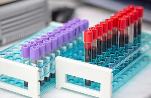 Tubes of blood sample for testing Stock Photos