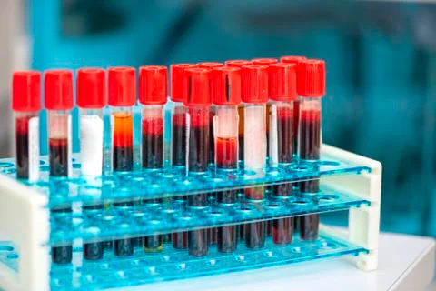 Tubes of blood sample for testing Stock Photos
