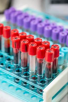 Tubes of blood sample for testing Stock Photos