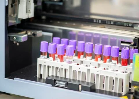 Tubes of blood sample for testing Stock Photos