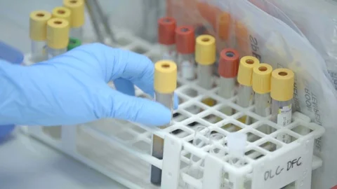 Tubes With Samples In Laboratories -50fps Stock-Footage 97846341