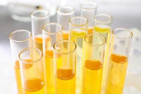 Tubes with urine samples for analysis on blurred background, closeup Foto stock