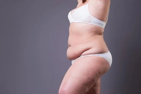 Fat woman in underwear, overweight female body on gray background