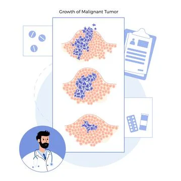 Tumor cells concept Stock Illustration