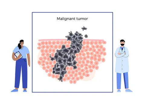 Tumor cells concept Stock Illustration