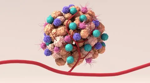 Tumor microenvironment, normal cells, molecules, and blood vessels that surround Stock Illustration