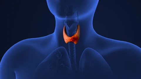 Tumor spread in the thyroid gland Stock Footage 277259359