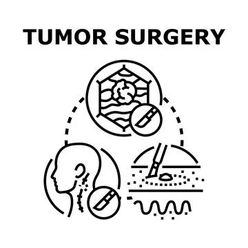 Tumor surgery concept vector illustrating medical procedure Stock Illustration