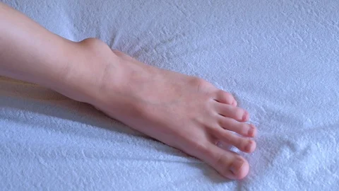 Tumor, trauma, inflammation of joint, leg ankle hygroma in joint, foot closeup. Video stock 123778441