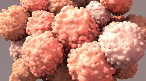 Tumours, group of abnormal cells that form growths Stock Illustration