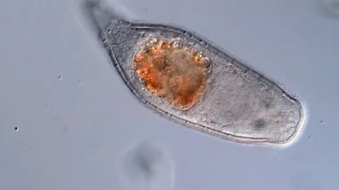 Turbellarian flatworm under microscope Vídeos de archivo 310640413