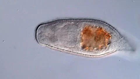 Turbellarian flatworm under the microscope 库存影片 310640416
