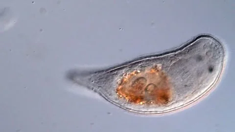 Turbellarian flatworm under microscopy view 스톡 동영상 310640436