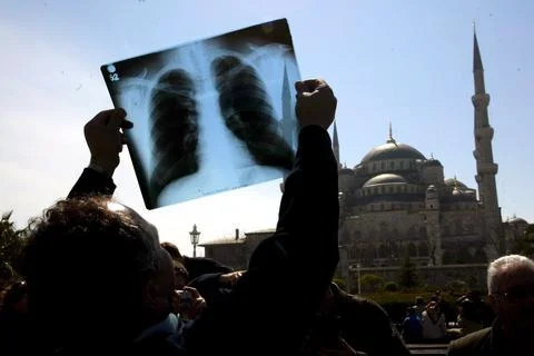 Turkey Total Solar Eclipse Istanbul - Mar 2006 Foto stock