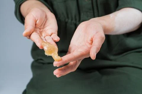 Tutorial hair removing sugaring, depilation, waxing 库存照片