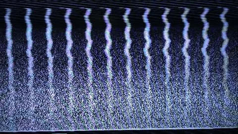 TV Distorted Signal Problems Glitch Stock Footage 83702624