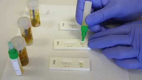 Twisting off the test tube to drip human stool sample onto rapid test Stock Footage 245482722