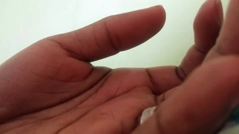 Twitchy Thumb Stock Footage 156056186