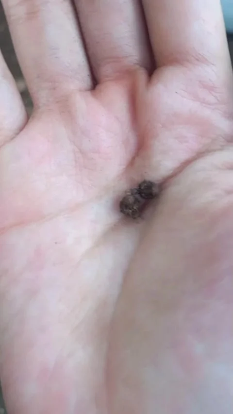 Two Antlions Curled Up in Hand — Vertical Close Up 库存影片 340888574