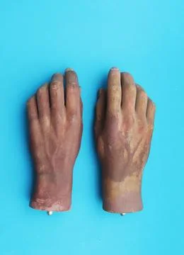 Two artificial hands on blue background top view. Stock Photos
