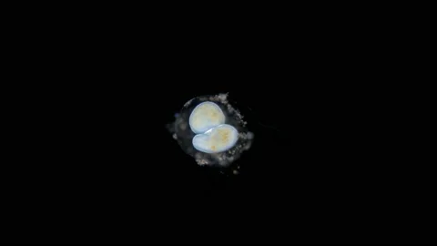 Two ciliates Ciliophora under the microscope, Alveolata. Stock Footage 166089088