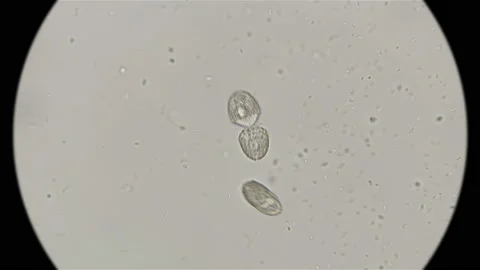 Two ciliates Coleps at the stage of division, under the microscope Stock Footage 97309261