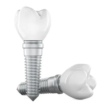 Two Dental implants. 3D rendering Stock Illustration