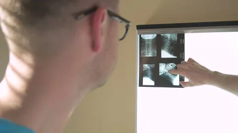 Two doctors are looking at their patient x-ray. Video stock 62948825