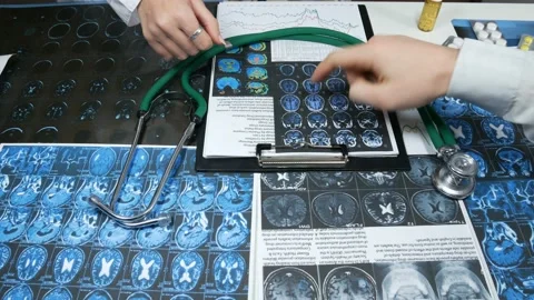 Two doctors examine x-rays 動画素材 88440524