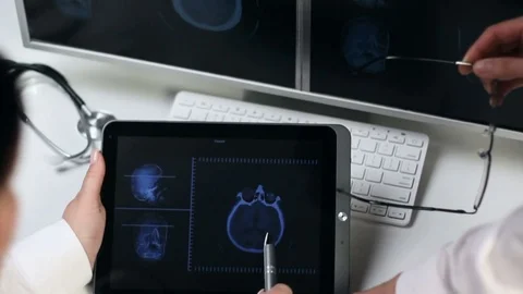 Two doctors examining a CAT scan Stock Footage 73007971