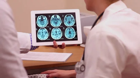 Two doctors looking at brain scans 스톡 동영상 35087697