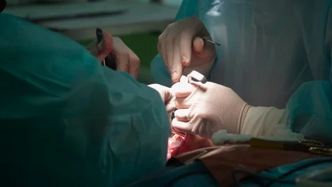Two doctors perform an operation on a patient’s face. Stock-Footage 123569615