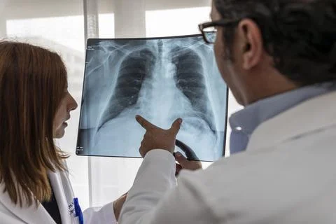 Two doctors read a chest x-ray Stock Photos