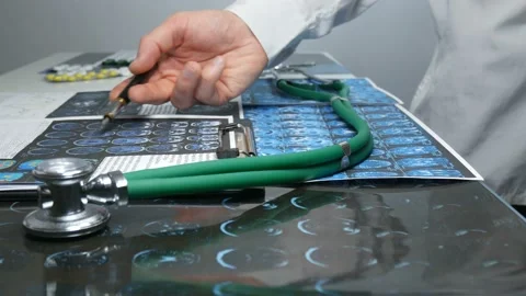 Two doctors work in the hospital Video stock 88295575