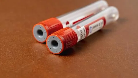 Two empty blood test tubes, close-up, selective focus Stock Photos