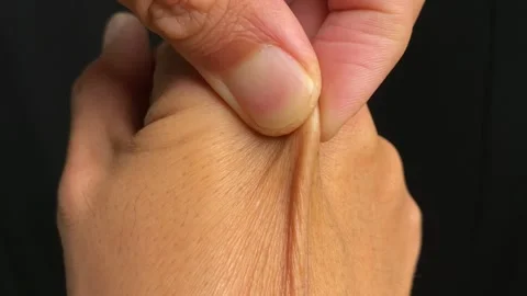 Two fingers pinching back of hand brown skin elastic close up. Skin health Stock Footage 250166897