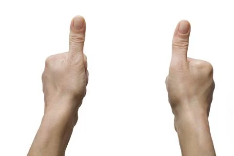 Two hands with thumb up Stock Photos