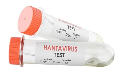 Two hantavirus test specimen tubes, 3D Rendering Stock Illustration