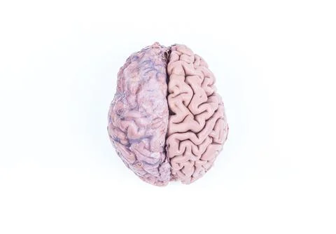 Two hemisphere of a real human brain isolated on white Stock Photos