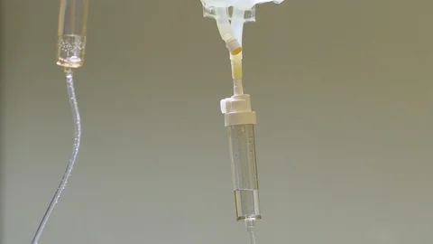 Two hopsital iv drips running at the same time 库存影片 93668103