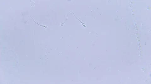 Two human sperms under Bright field Microscope 스톡 동영상 80254345