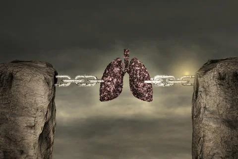 Two mountains connected with a chain by disease lung in sunset day. Stock Illustration