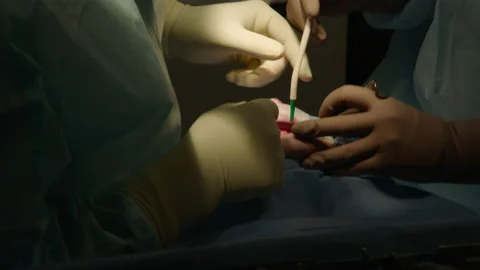 Two professional doctors perform dental surgery Stock Footage 236048753