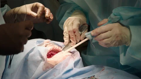 Two professional doctors perform dental surgery Stock Footage 236053352
