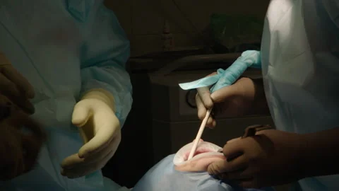 Two professional doctors perform dental surgery Stock Footage 236054672